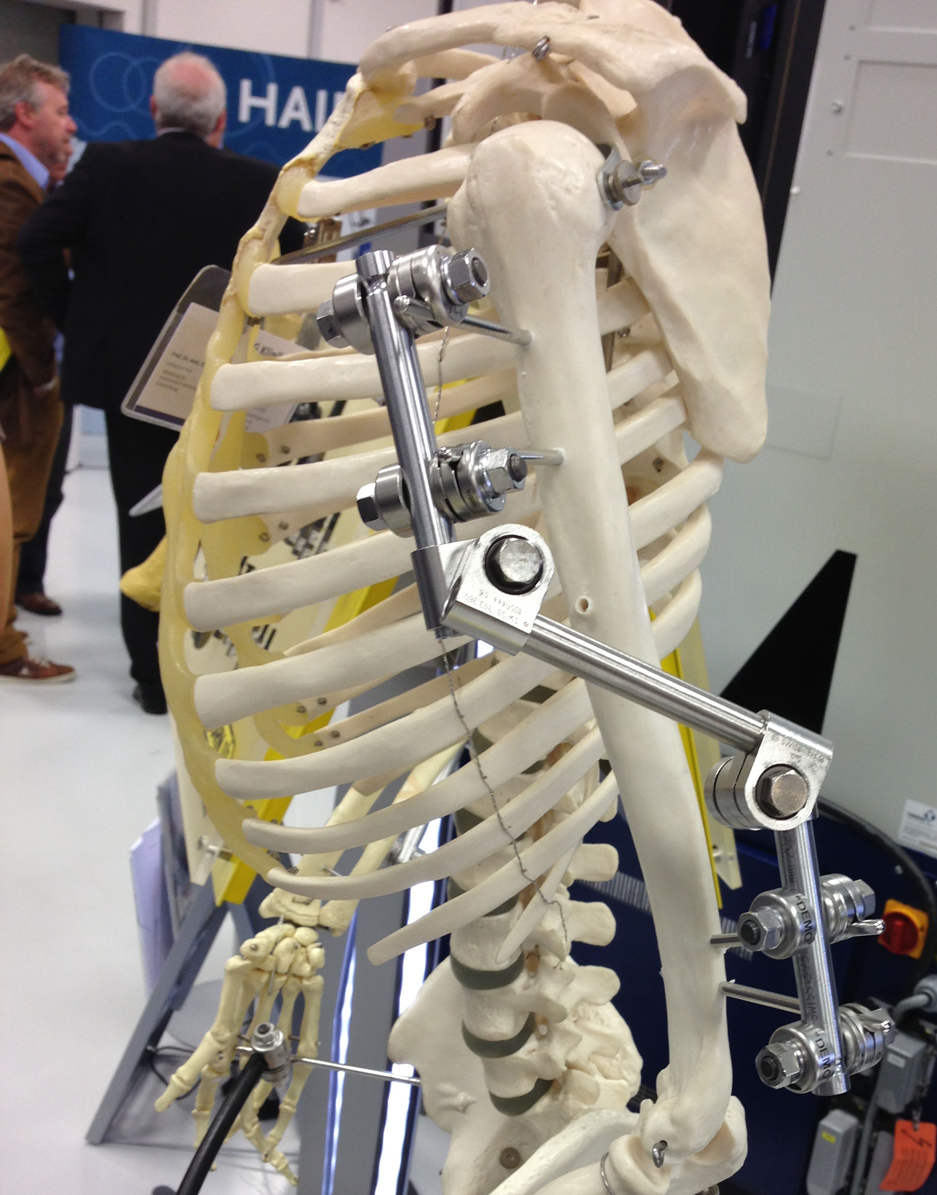 External Fixation, Artificial Joints, Human Spare Parts...